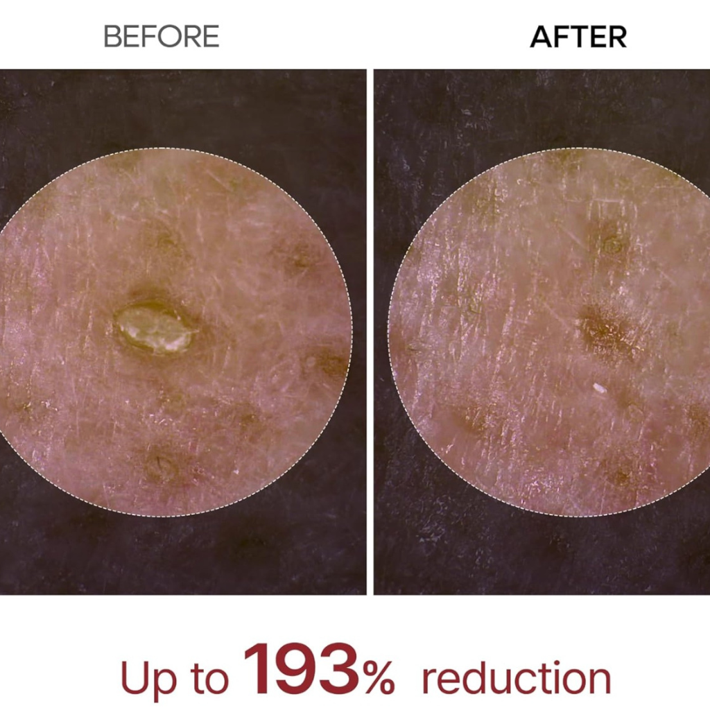 Dr. Melaxin Peel Shot Glow : White Rice Peeling Ampoule